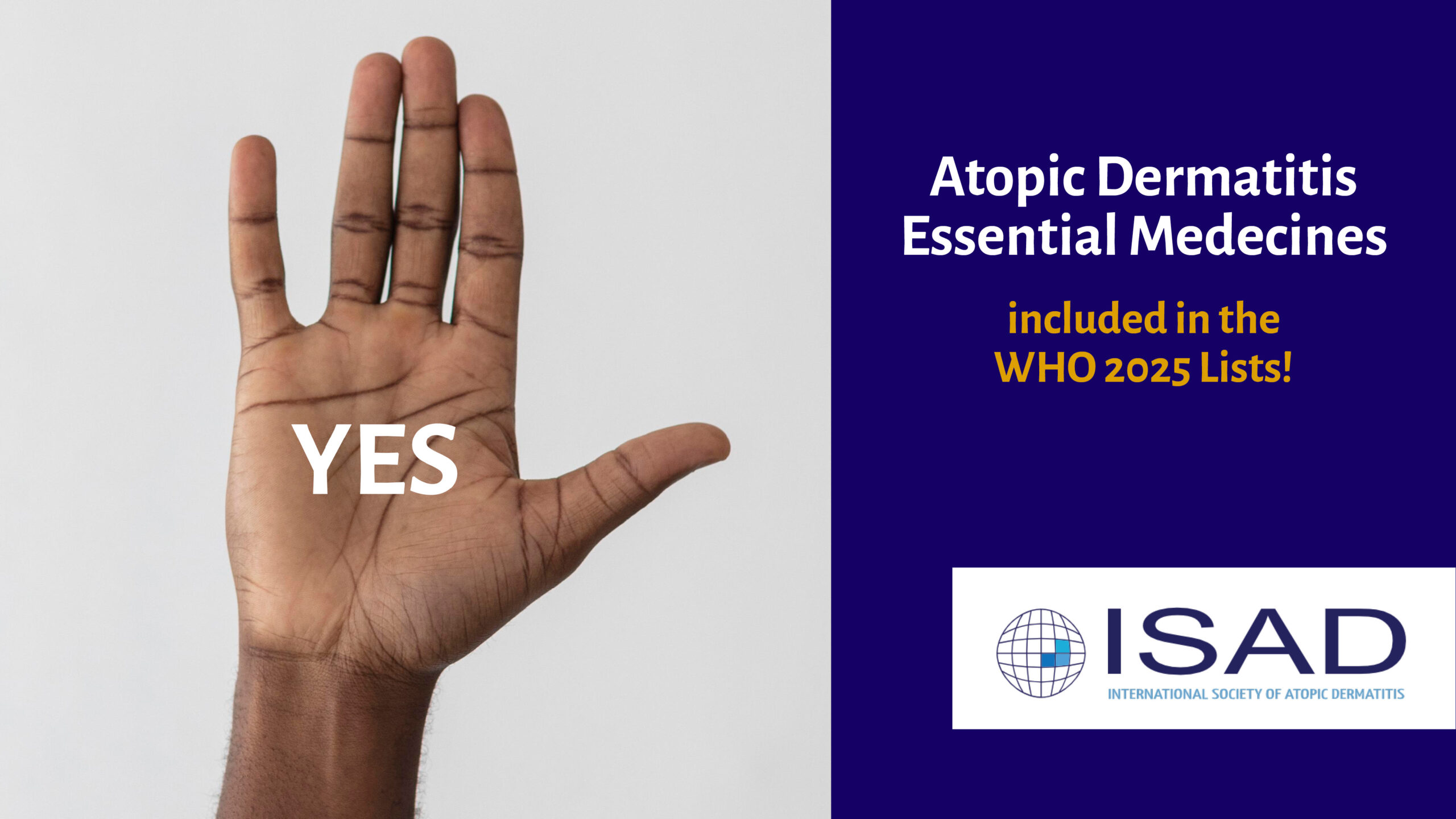 Read more about the article  WHO – Atopische Dermatitis – Essential Medicines Lists :  Aufnahme feuchtigkeitsspendende Cremes auf Harnstoff- und Glycerinbasis